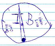 IB Care Meter